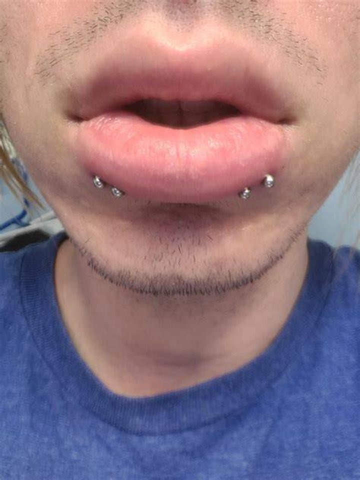 Shark Bites Lip Piercings Are The Update To An Early 2000s Emo Trend